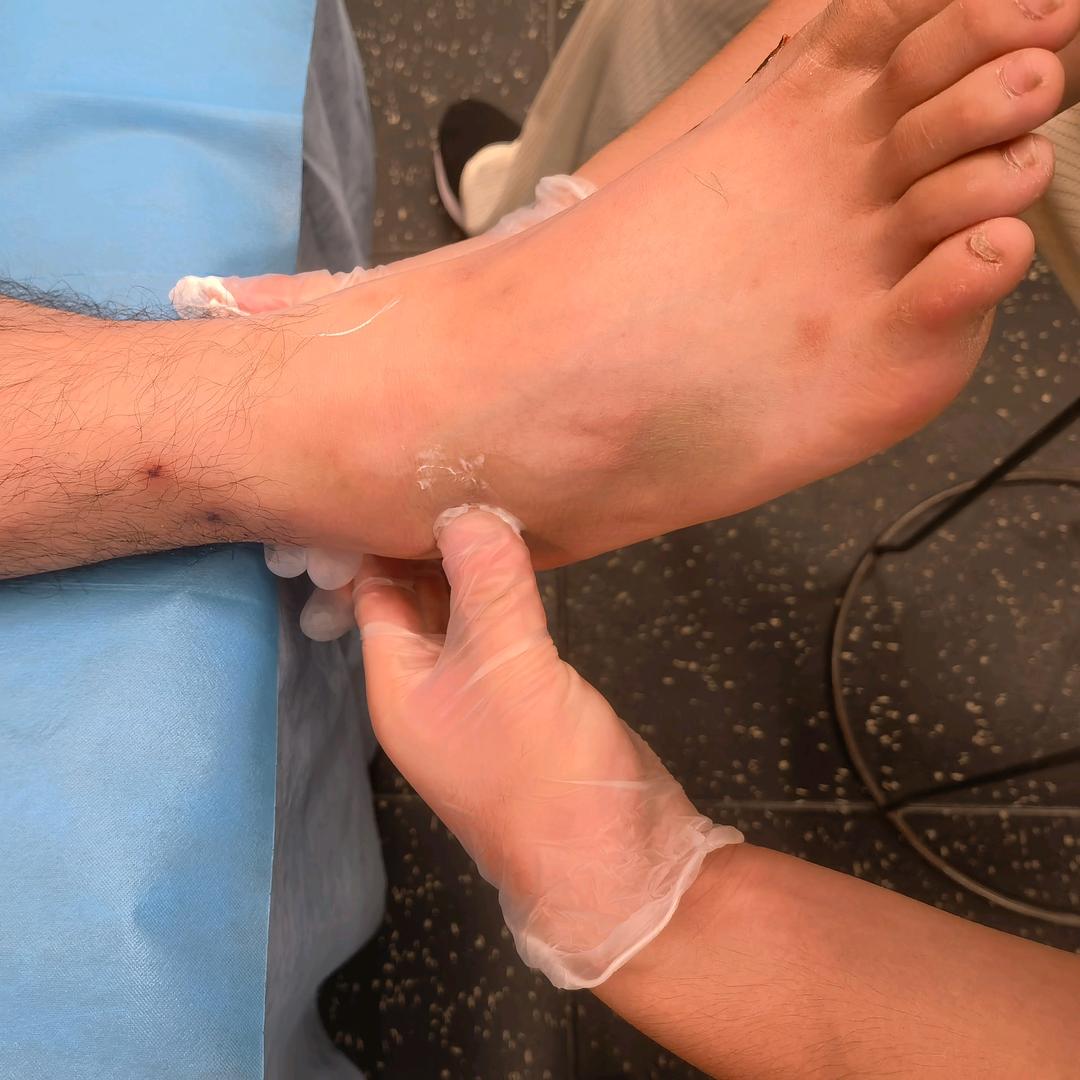 合肥羽涅康复师——李