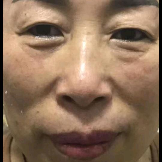 石佛寺米线姐护肤品修复改善