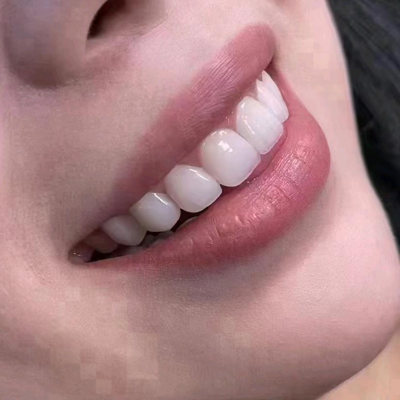 美呀呀