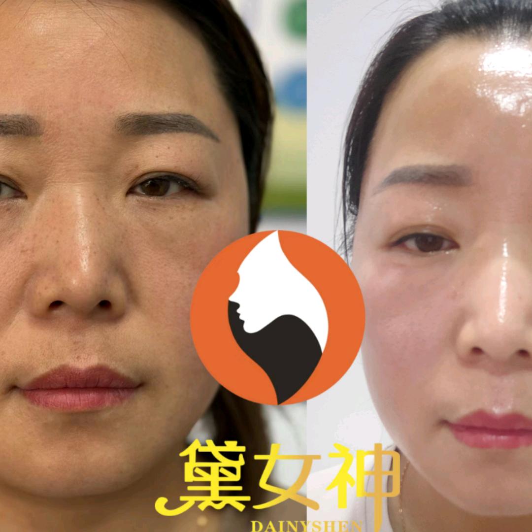 黛女神祛斑净肤