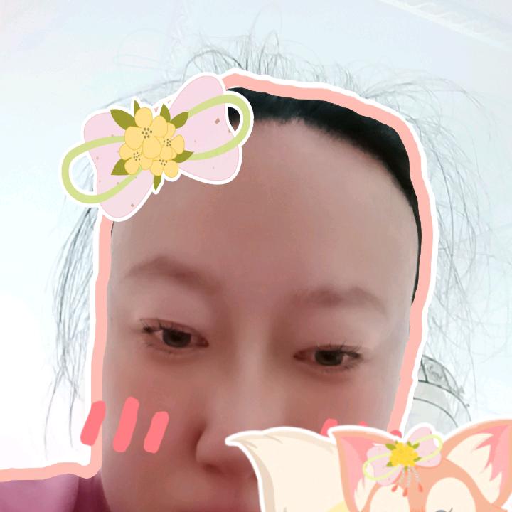 卢伟