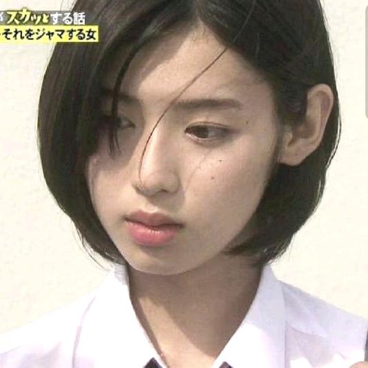 王子病