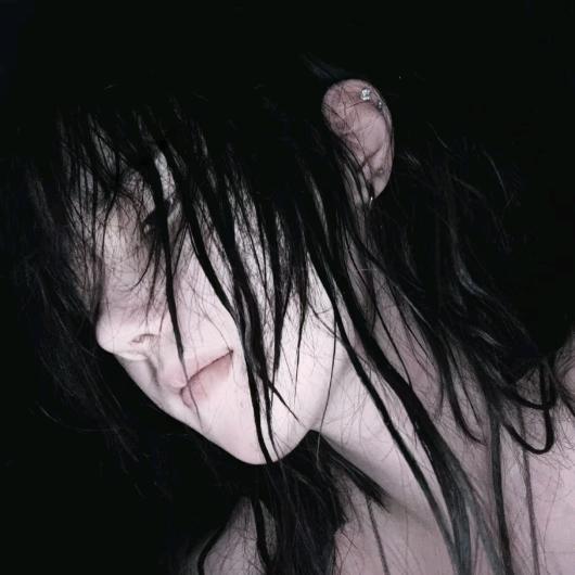 锯齿切割视神经