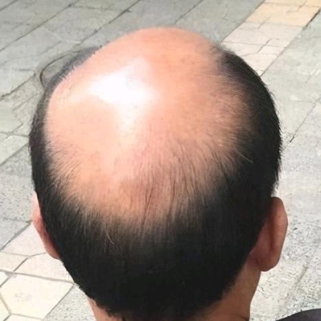 三金养发日记