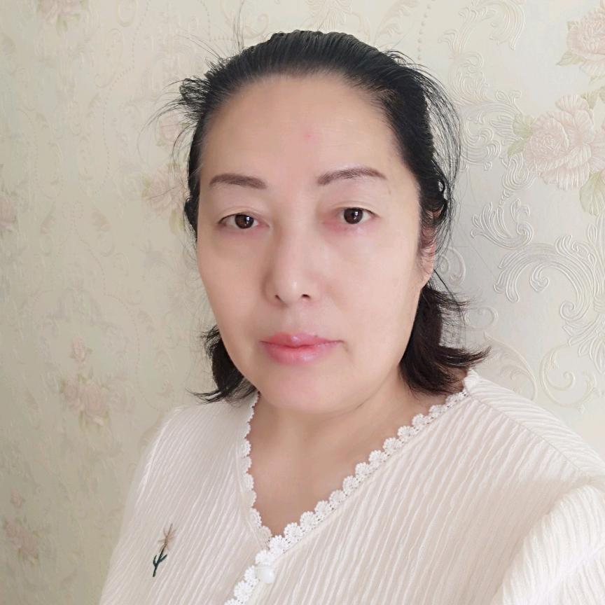 阳光姐