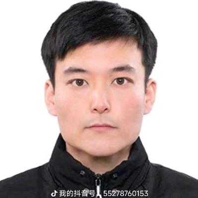 股骨头王修人三期保守成功5公里跑30分钟