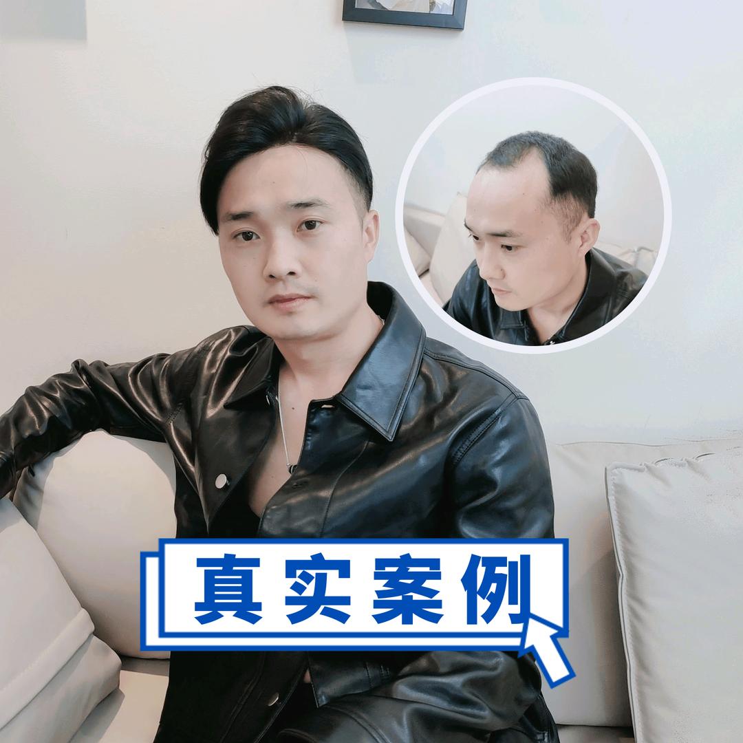 EEIZZ伊正假发