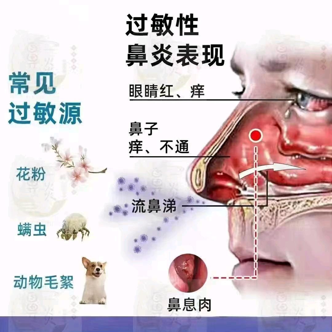 关爱鼻腔 呵护健康