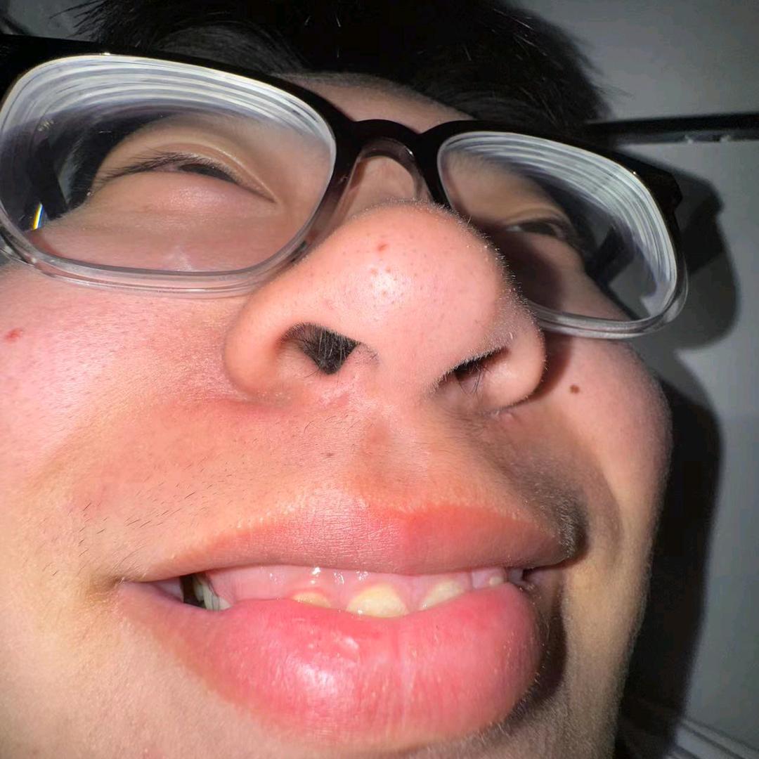 😋😋😋😋