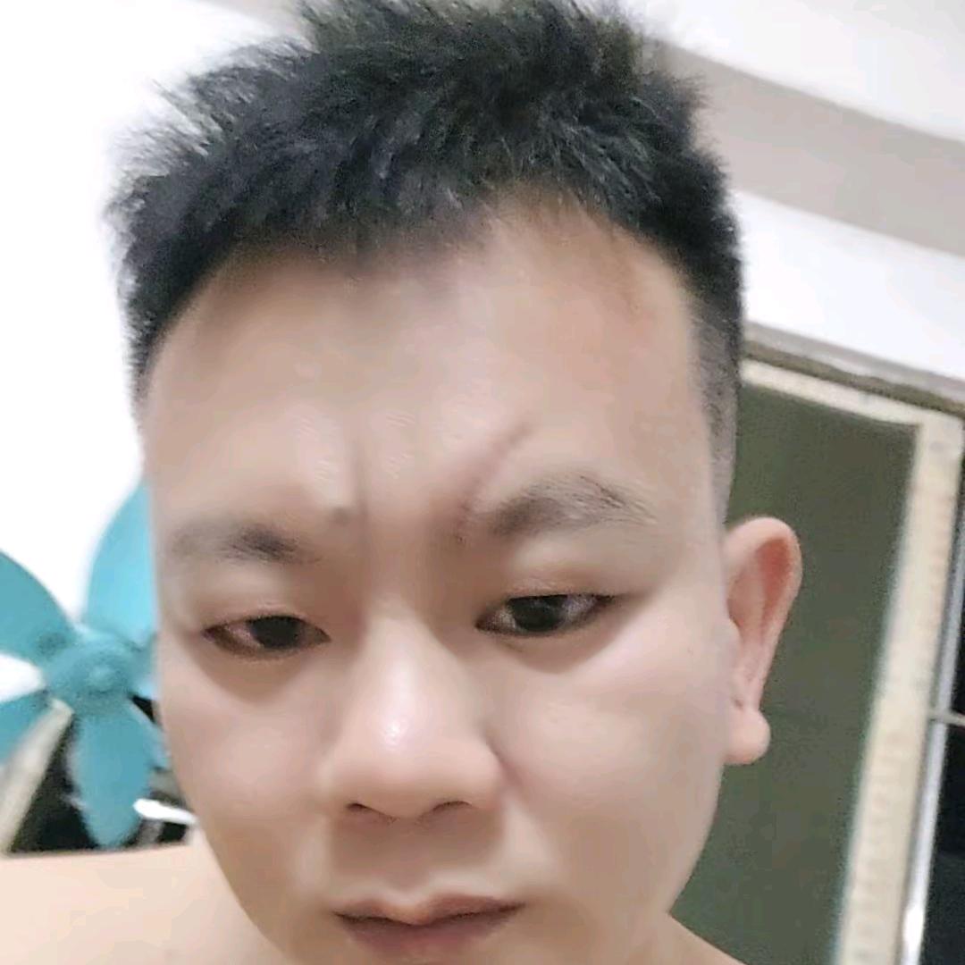 小瓶盖,