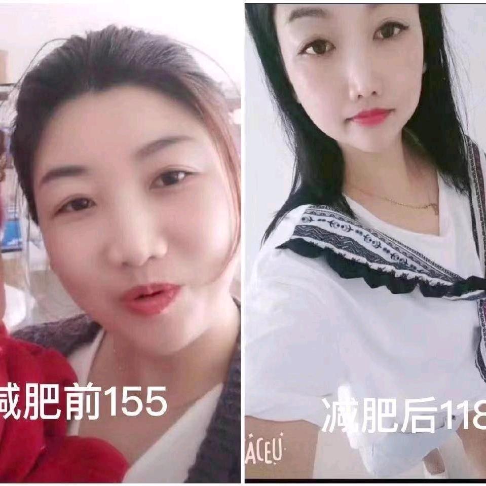 城言瘦美人（赵德营店）