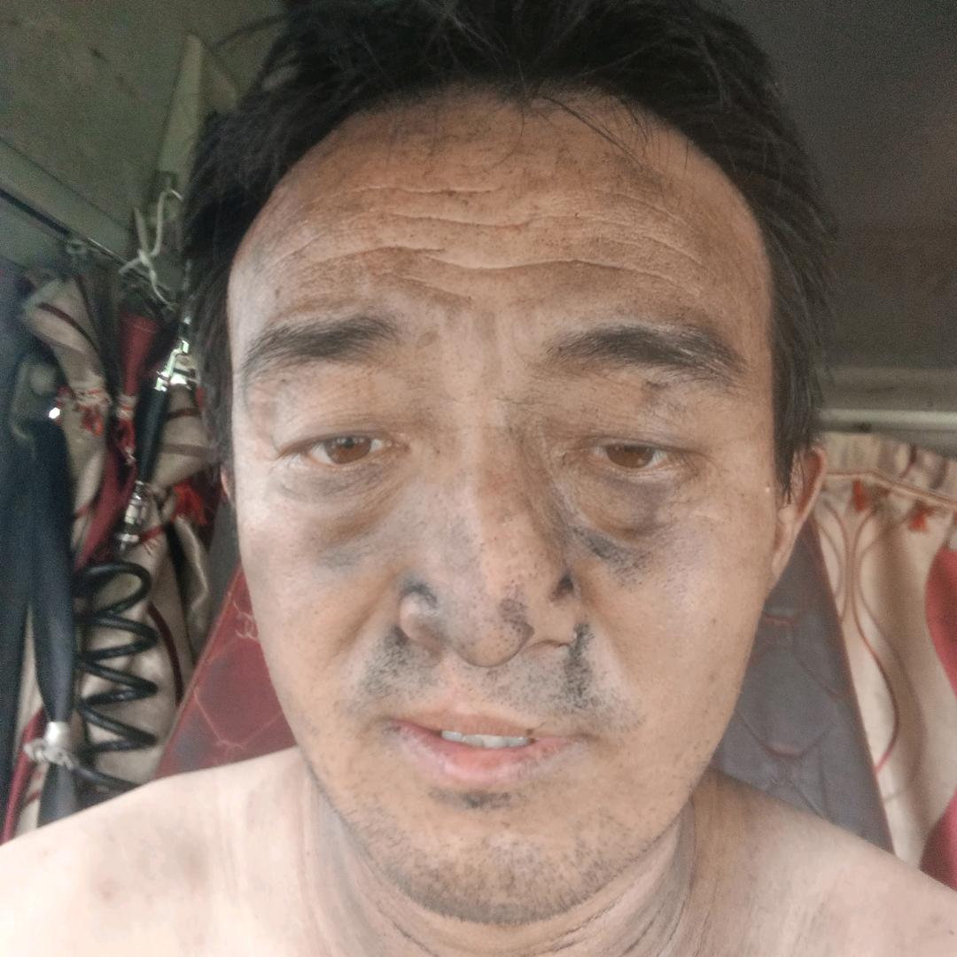 抖音哥我的腿 | |