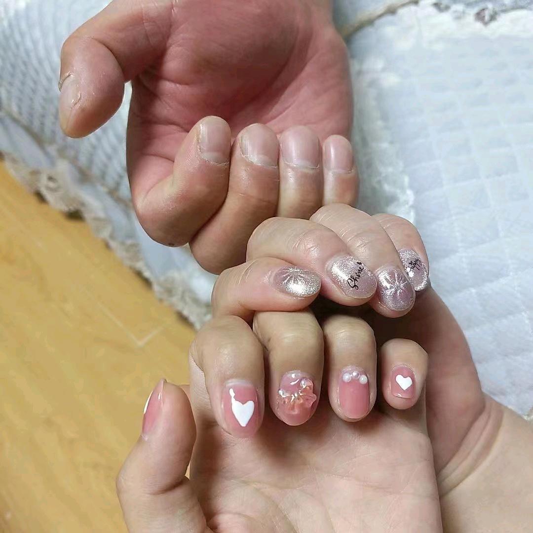 小手冰凉