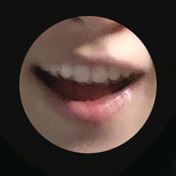 嘻嘻