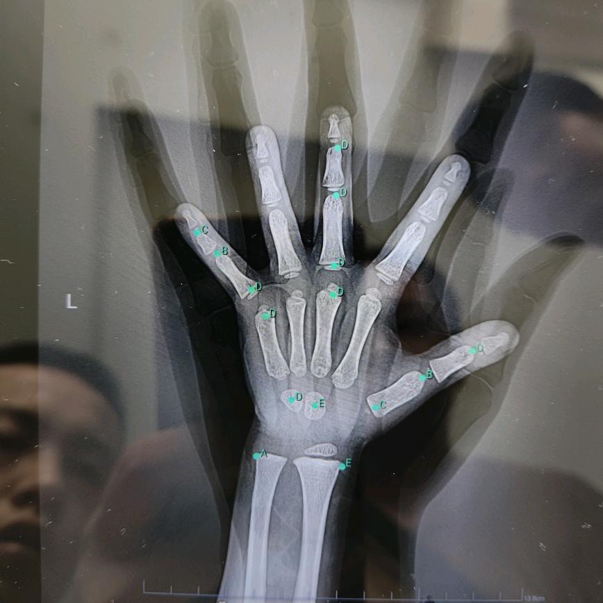 吃人陈吴所谓Trần Quang Diệ