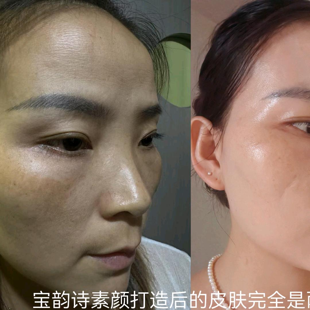 我是容容，宝韵诗专注打造素颜好皮肤