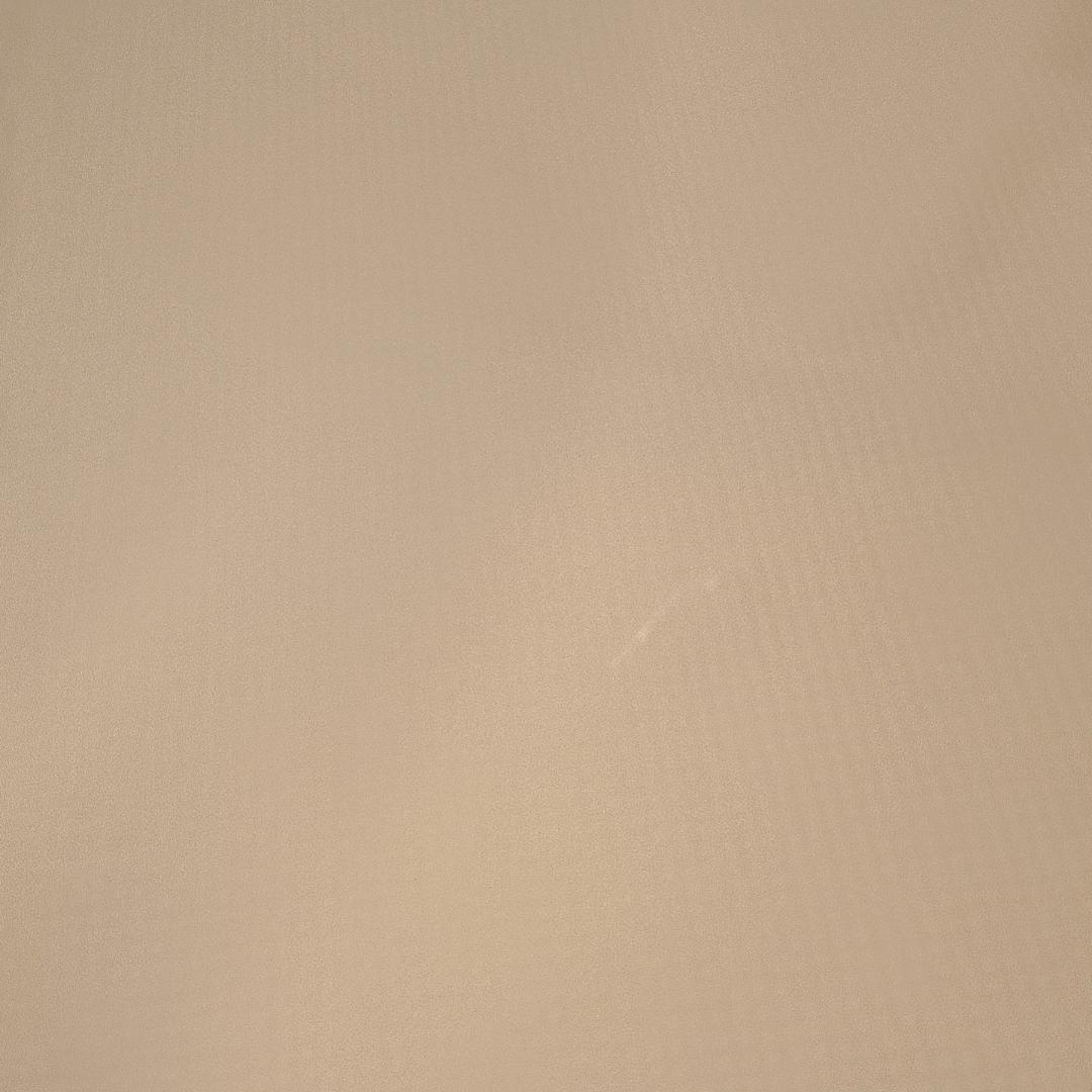 <园洲经理>有点小U伤