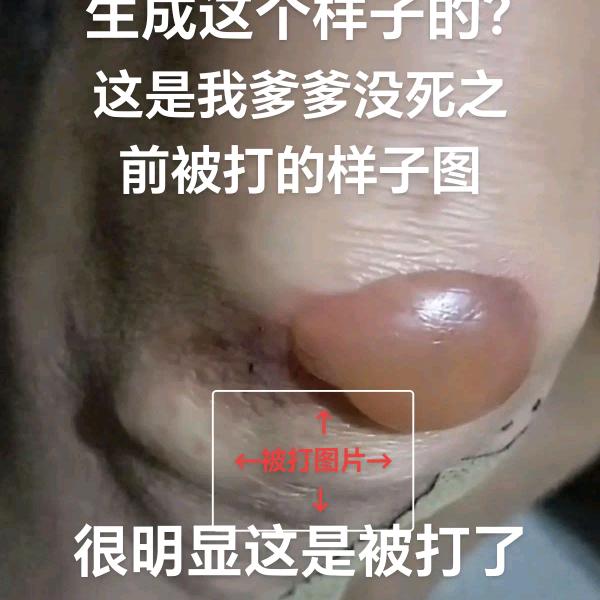 段旺先4孩单爹含障娘被恶首打爆废了身体脑