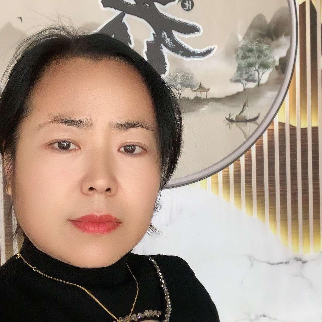 曲阳去屑生发王姐