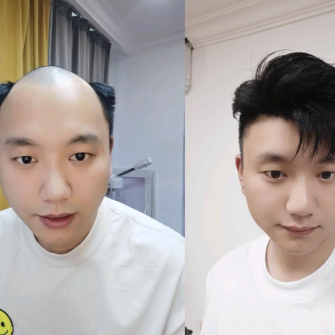 黄石千寻专业假发定制