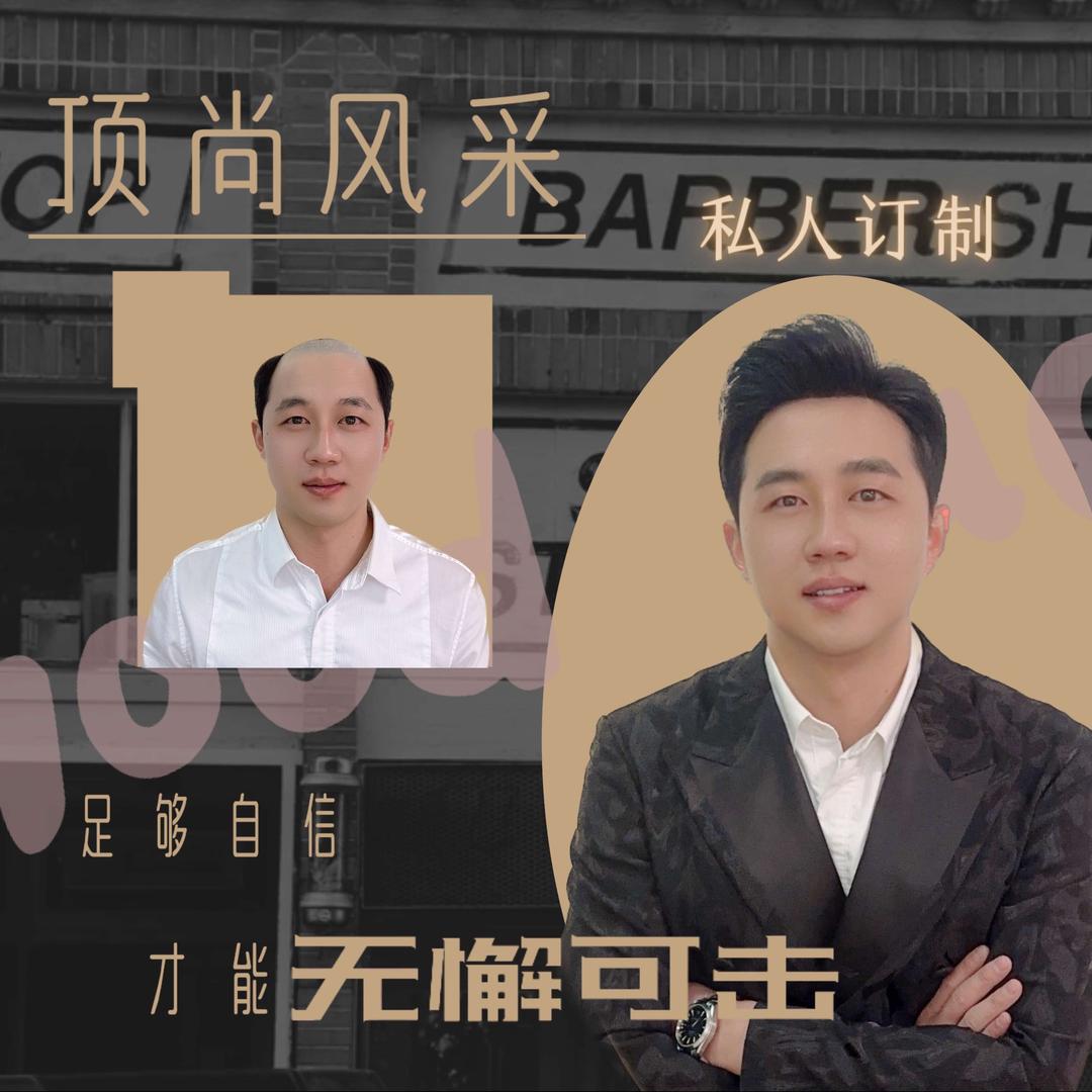 拉萨顶尚风采定制假发补发